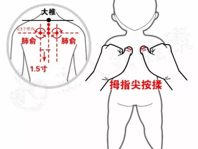 学小儿推拿的地方(学小儿推拿去哪里学)